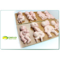 ANATOMY14 (12452) Demonstrator Deformities in Kleinkinder, 8 Stück in einer Serie, Anatomie Modelle&gt; Fetal Malformation Model 12452